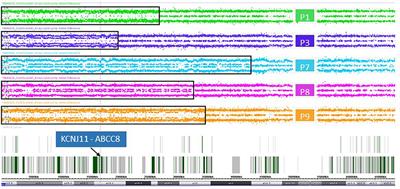 Integration of genomic analysis and transcript expression of ABCC8 and KCNJ11 in focal form of congenital hyperinsulinism